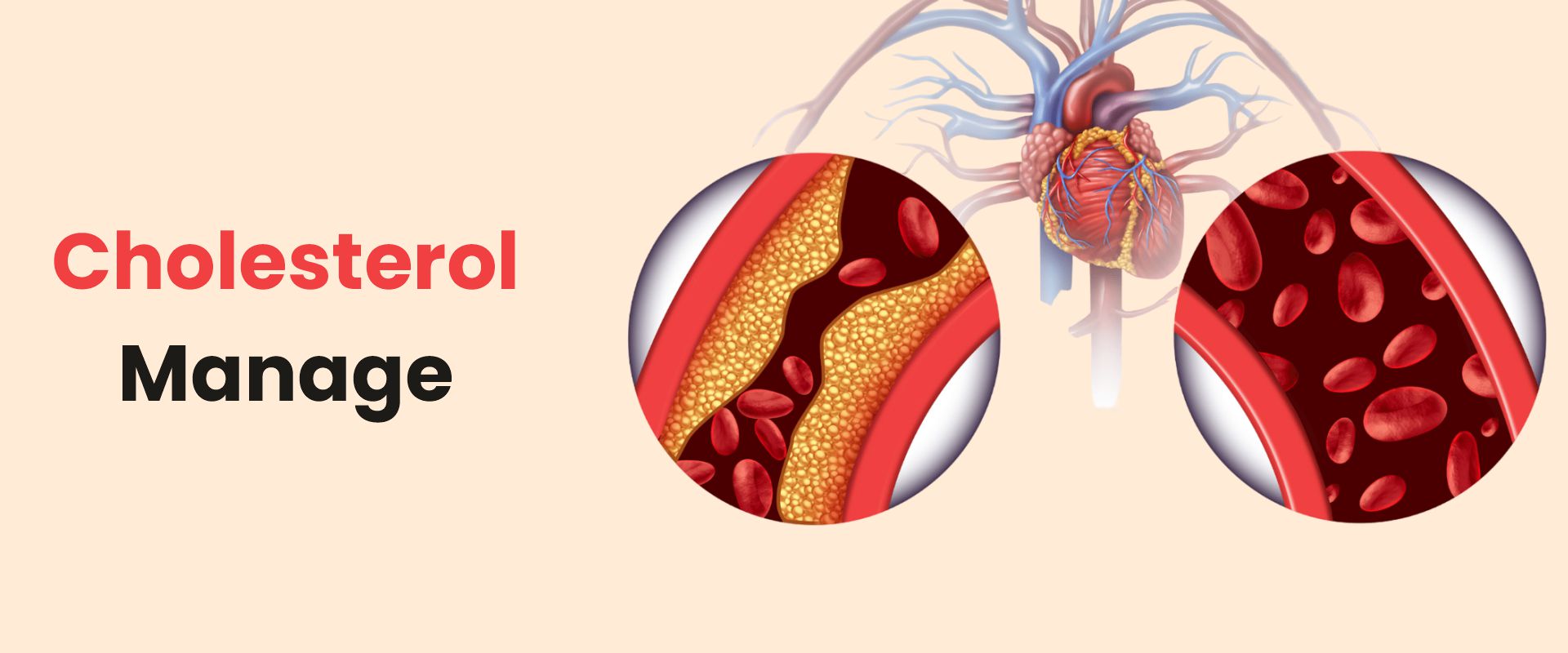 Cholesterol Manage