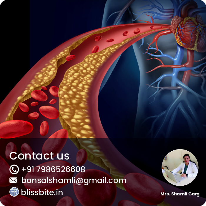 Cholesterol Manage